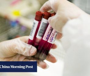2 Hong Kong labs linked to suspected cross-border smuggling of blood samples