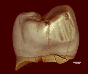 A Neanderthal Molar