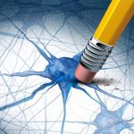 Alzheimers Dementia Brain Disease Concept