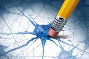 Alzheimers Dementia Brain Disease Concept