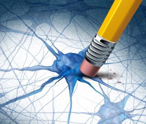 Alzheimers Dementia Brain Disease Concept