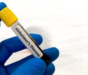 Alzheimer's Disease Blood Test Tube