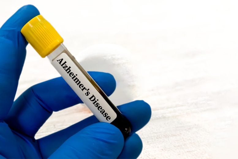 Alzheimer's Disease Blood Test Tube