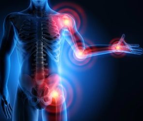 Body Anatomy Inflammation Painful Joints