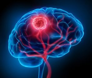 Brain Cancer Blood Vessels Tumor