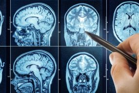 CT Scan With Brain and Doctor’s Hand Pointing