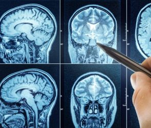 CT Scan With Brain and Doctor’s Hand Pointing