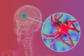 Human Brain Parkinsons Disease Neuron