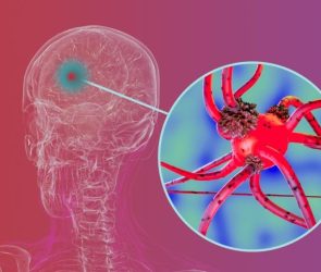 Human Brain Parkinsons Disease Neuron