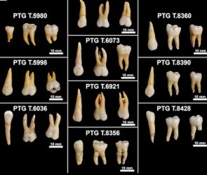 Iron Age teeth reveal the hidden lives of ancient Italians
