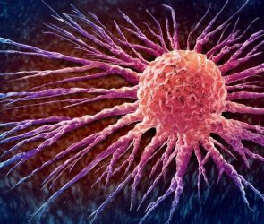 Malignant Cancerous Growth Cancer Cell Spreading