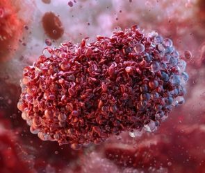 Monkeypox Virus Zoonotic Orthopoxvirus