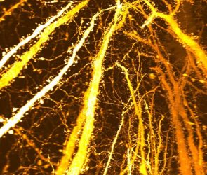 New Synaptic Formation Adolescent Brain