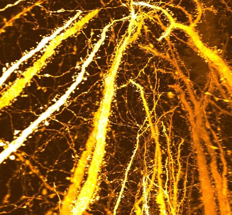 New Synaptic Formation Adolescent Brain