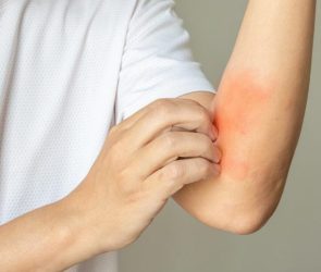 Scratching Itchy Skin Rash