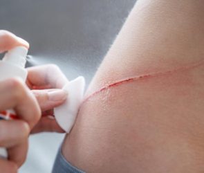 Spray Antiseptic Cut Scratch Wound