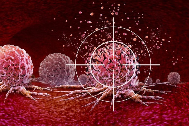 Ultrasound Cancer Treatment Target