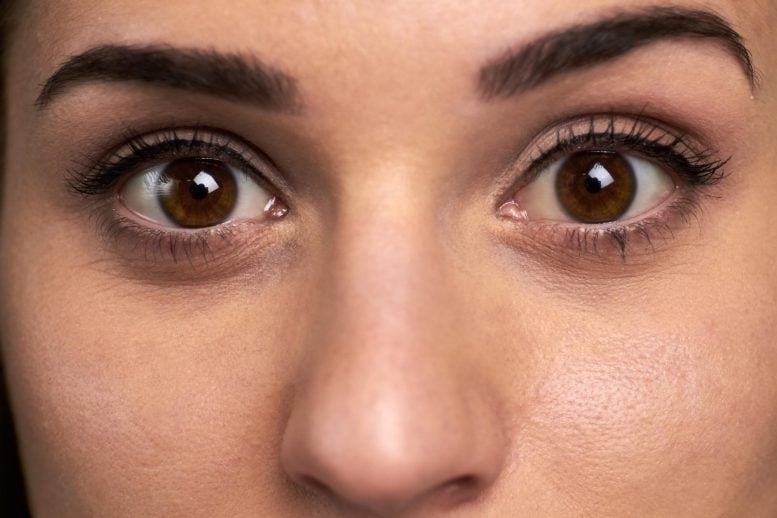 Young Woman Wide Open Eyes