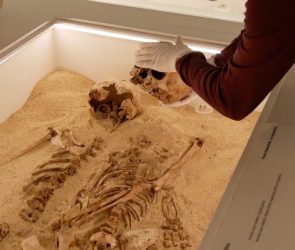 Skeletons reveal Stone Age mother and daughter had a rare genetic condition