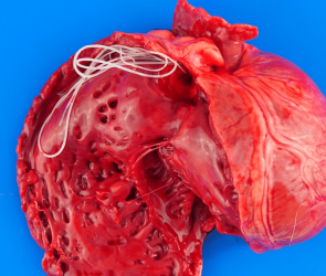 This deadly dog ‘spaghetti’ has ancient origins