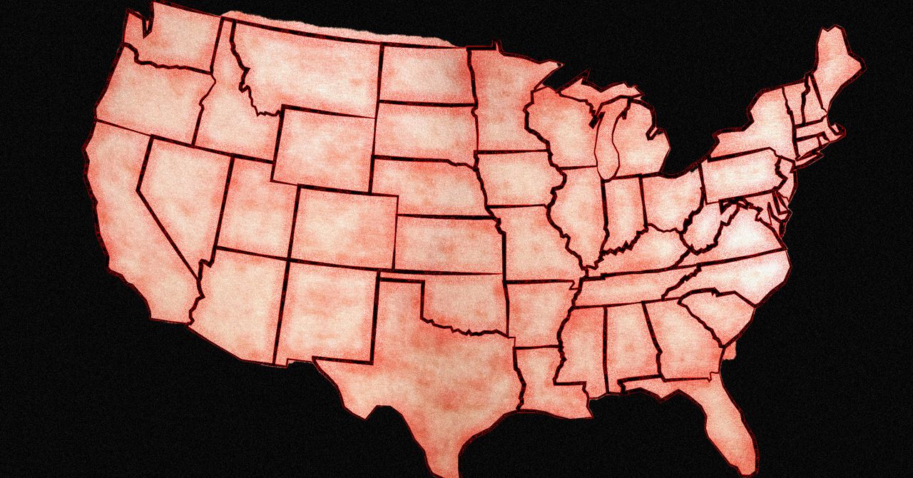 The US Is In For Another Bad Year of Measles Cases