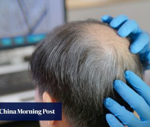 Hongkonger denied refund after HK$88,000 hair treatment causes scalp bleeding
