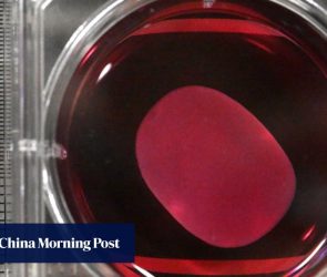 Japan approves world’s first regenerative medicines using iPS cells