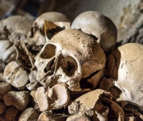 Aged Human Skull Bones