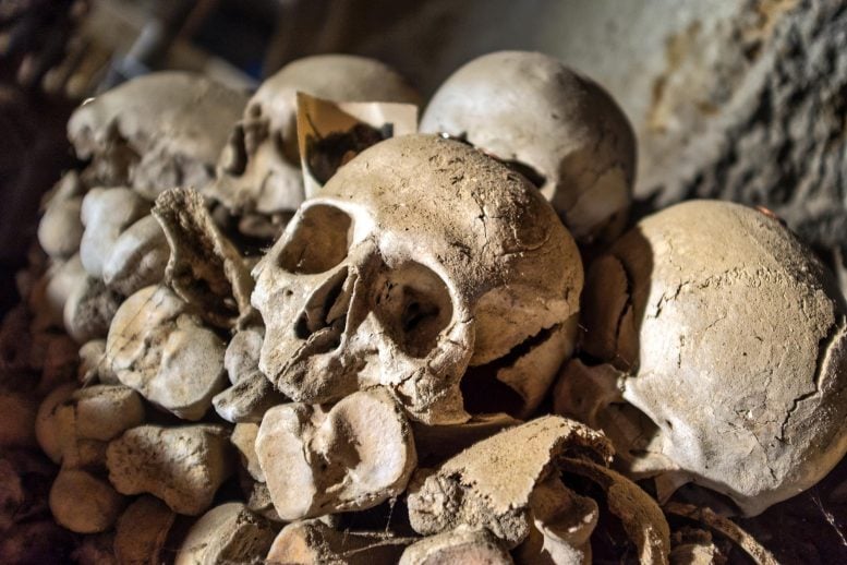 Aged Human Skull Bones