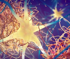 Amyloid Plaques Forming Between Brain Neurons