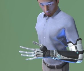 Autonomous Prosthetic Arm