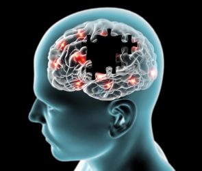 Brain Missing Puzzle Pieces Parkinson's Alzheimer's Degenerative Diseases