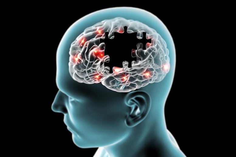 Brain Missing Puzzle Pieces Parkinson's Alzheimer's Degenerative Diseases