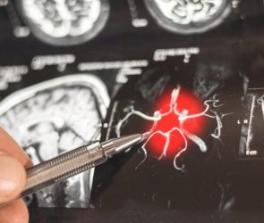 Doctor Examines Brain Scan Disease Treatment