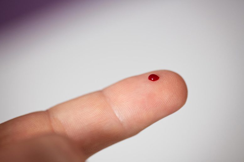 Finger Prick Blood Drop Testing
