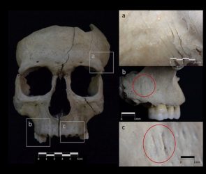 Severed head rituals were more widespread in Iron Age Iberia than we thought
