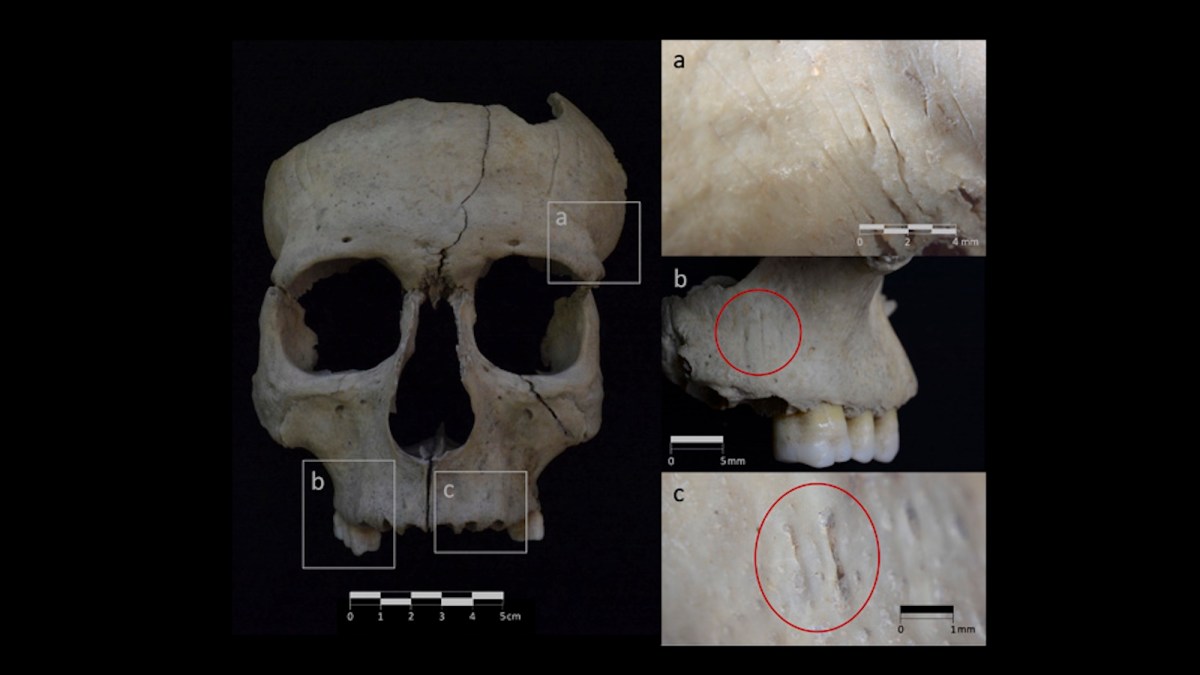 Severed head rituals were more widespread in Iron Age Iberia than we thought