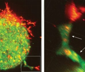 Mesothelial Cells Lead Invasion
