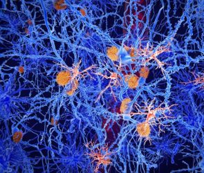 Microglia Cells Brain Neuroscience Alzheimer’s Disease