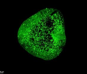 Midbrain Dopaminergic Neurons