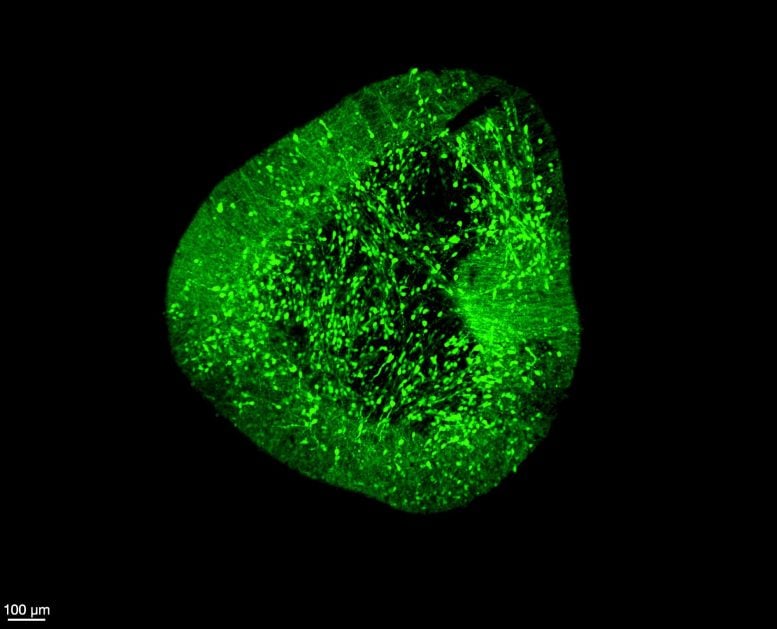 Midbrain Dopaminergic Neurons