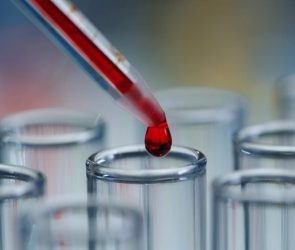 Science Lab Blood Red Liquid Test Tubes