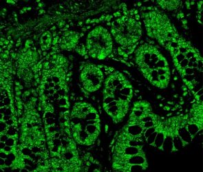 Serotonin Receptors in Gut