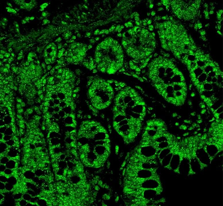 Serotonin Receptors in Gut