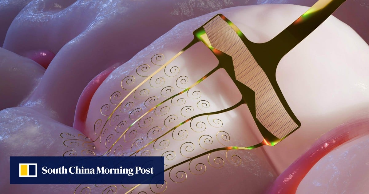 Japanese paper-cutting art inspires flexible brain implants in China