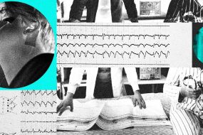 Technology Is Reshaping Sleep Apnea Treatment