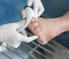 Bandaging Infected Diabetic Foot Wound