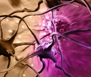 Brain Cancer Cells Neurons