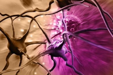 Brain Cancer Cells Neurons