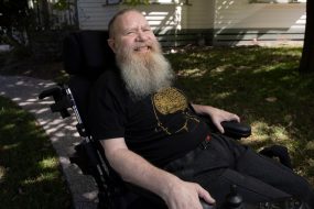 What It’s Like to Have a Brain Implant for 5 Years